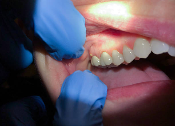 Best Emergency Dentist for Lost Fillings or Crowns in Little Flock, AR
