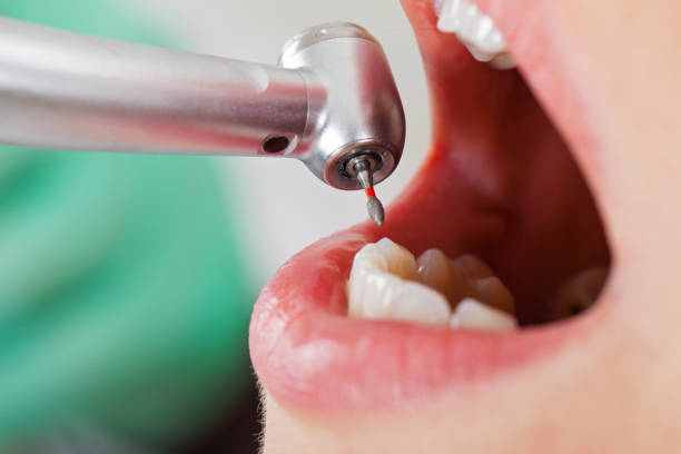 Best Emergency Dentist for Special Needs Patients in Little Flock, AR